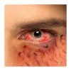 Lentilles Sclera 6 Mois Enfer